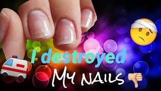 I destroyed my nails 😱😭 #sos nail care routine| thin damaged nails