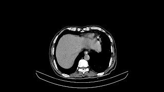 Case of the Day - 27 Nov 24