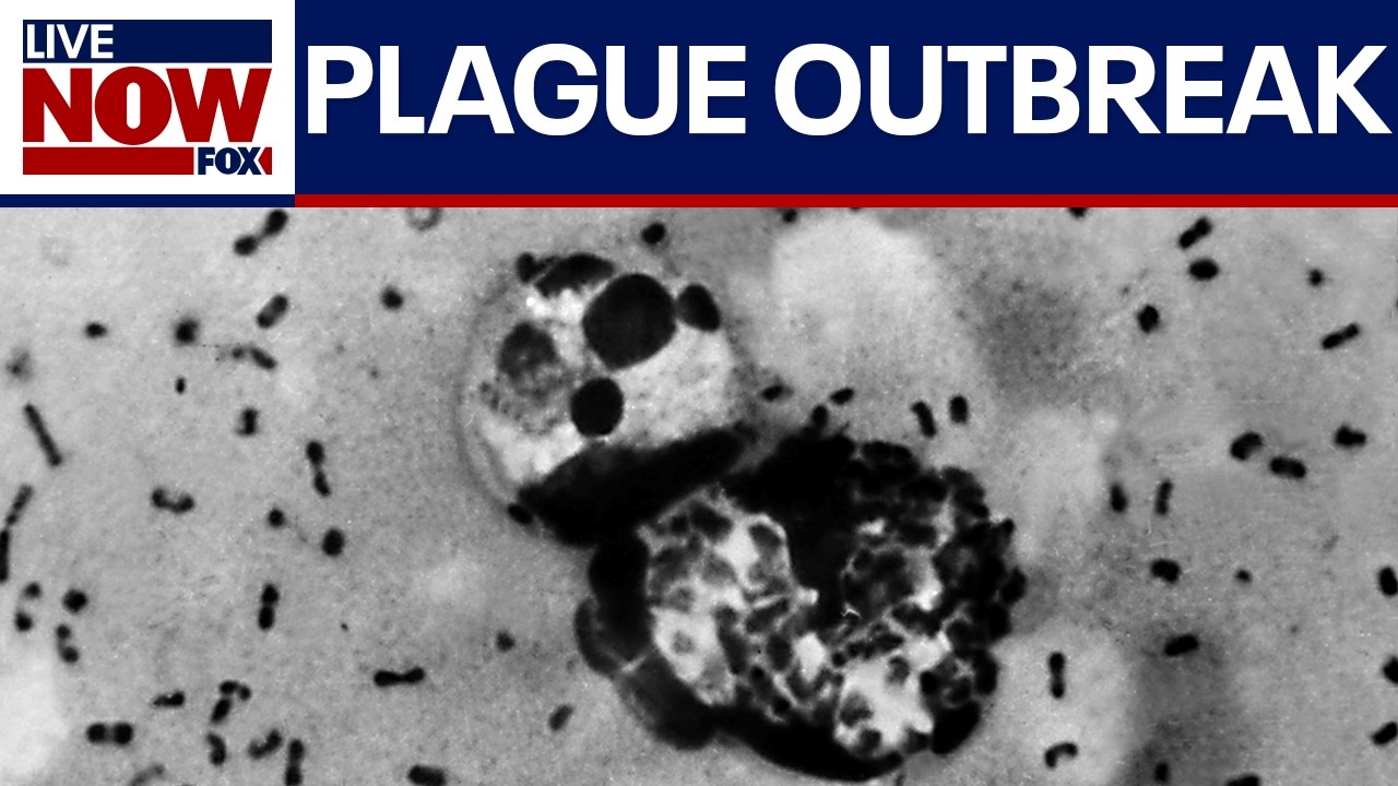 Suspected plague outbreak erupts in Russia after scientist dies