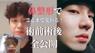 韓国 整形 男 Watch Hd Mp4 Videos Download Free