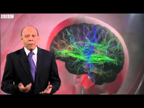 Brain scan study to understand workings of teenage mind