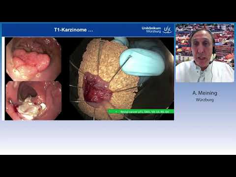 DGEBV Online 29 9 2021 Vortrag A. Meining