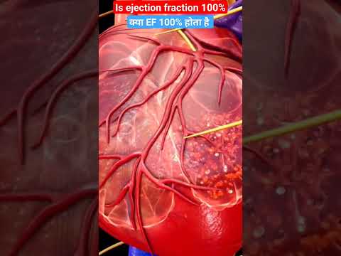 Is ejection fraction 100% l Is ejection fraction 100% l #shorts