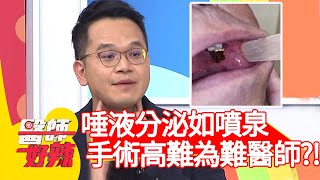 唾液分泌如噴泉，高難度手術為難醫師？！【@醫師好辣】20201026 part3 EP1038 許瓊月 潘映竹