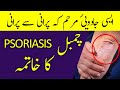 CHAMBAL Ka Ilaj چمبل Psoriasis Signs Treatment In URDU HINDI Hakeem Malik Ahmad Farooq