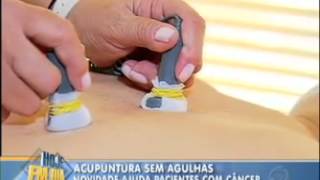 ACUPUNTURA CURITIBA   ACUPUNTURA A LASER SUBSTITUI AS AGULHAS