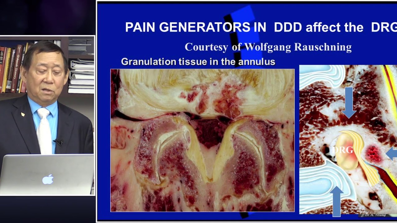 Master Talk: The Role of Endoscopic Surgery