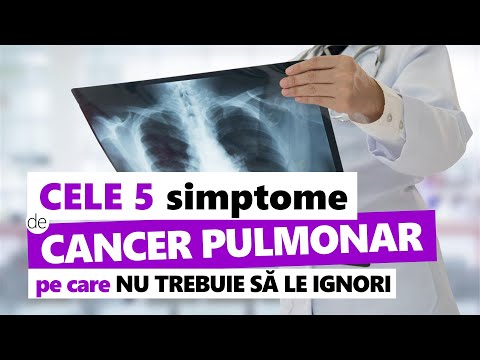 5 Simptome de Cancer Pulmonar pe Care NU Trebuie să le Ignori