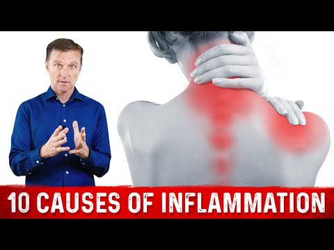 Deeper Causes of Pain Inflammation – Dr Berg