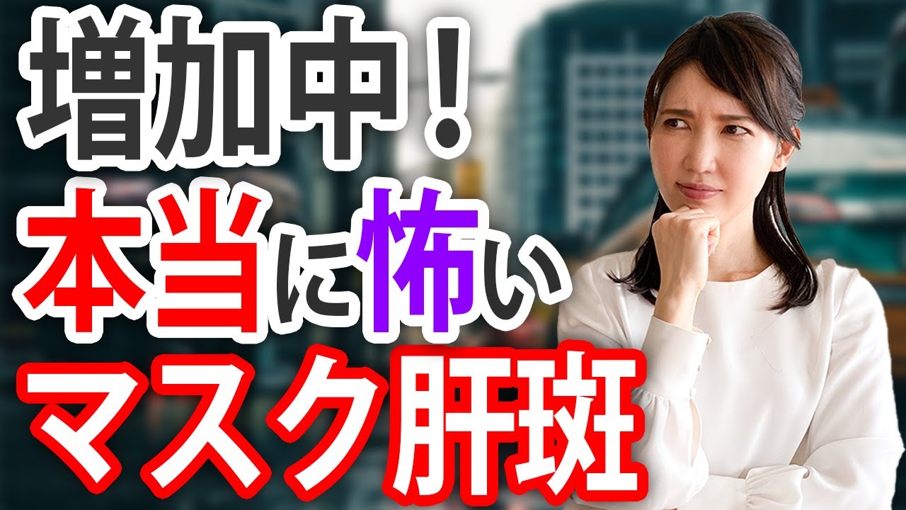 マスクで悪化する肝斑について解説します。