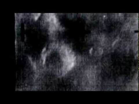 Kanoi : Suspicions Aside (Official Video)