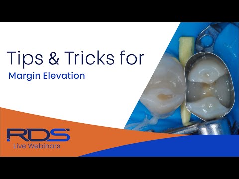 Tips And Tricks For Deep Margin Elevation