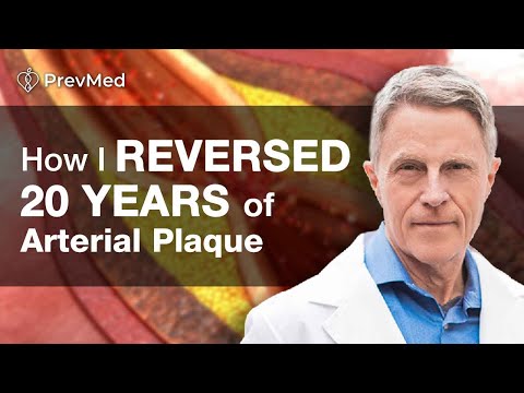 How I Reversed 20 years of Arterial Plaque