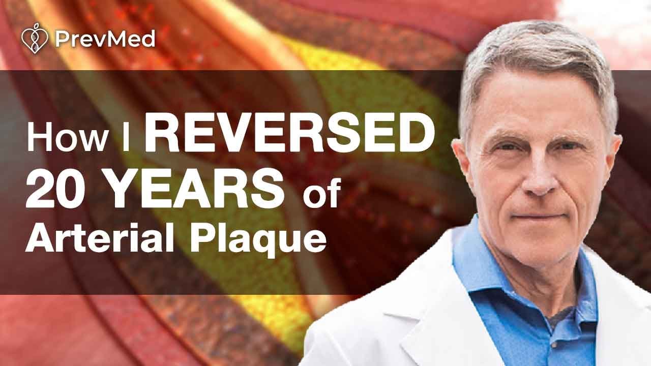 How I Reversed 20 years of Arterial Plaque