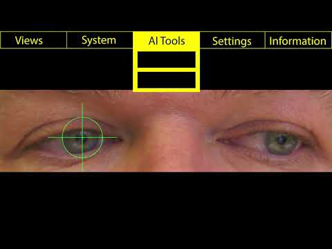 AI in Surgery - Künstliche Intelligenz (KI) in der Chirurgie