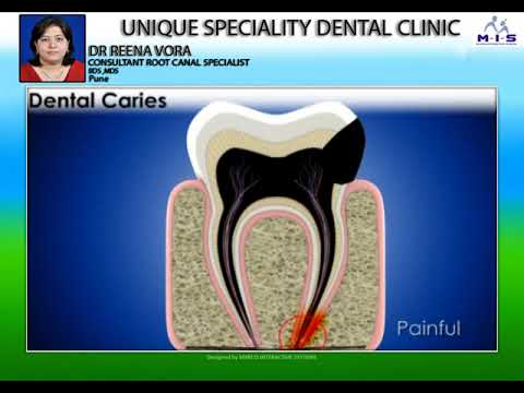 Dental Caries - causes &amp; Features | Dr. Reena Vora