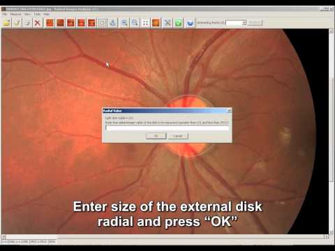 Retinal Images Analyzer