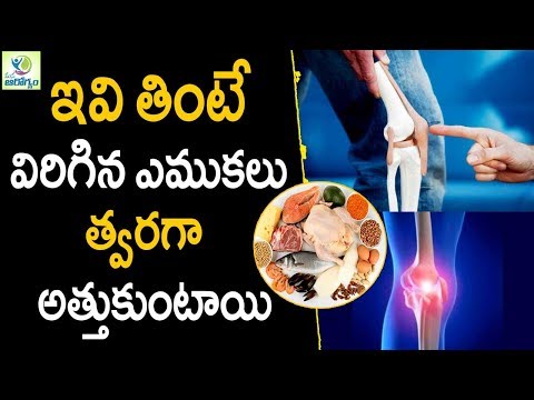 Bone Fracture Recovery Foods - Health Tips In Telugu || Mana Arogyam