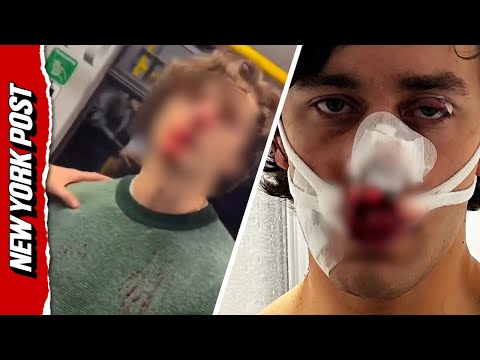 American model BRUTALLY slashed in Germany while defending two women