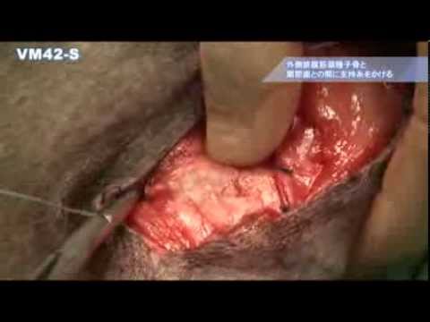 植物ベースの「死体探知犬」: 法医学者が人間の骨格をより迅速に発見する方法