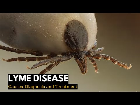 Gangrene Causes Signs and Symptoms Diagnosis and Treatment