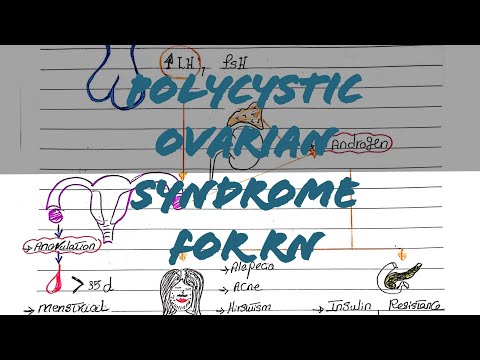 polycystic ovarian syndrome (PCOS) |تكيسات المبايض  by Tasneem Rashed
