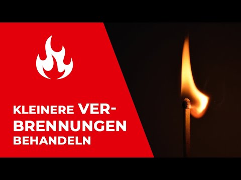 Einfach da für dich - wenn´s brenzlig wird