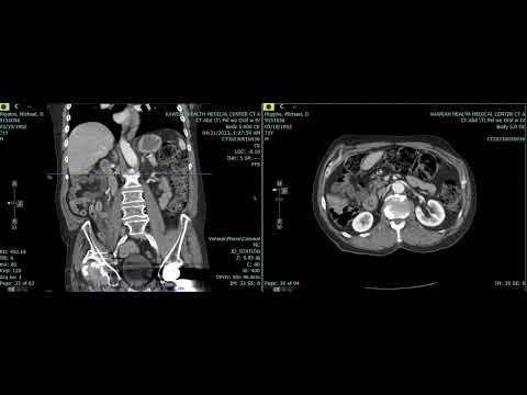 Screen Recording 2023 12 17 at 5 08 16 PM