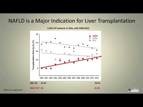 AASLD 2018 Update: Advancing Role of NITs in Liver Disease