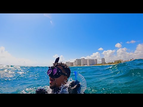 Florida man gets stung by Portuguese Man O’ War