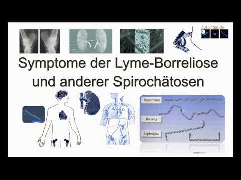 , title : 'Symptome der Lyme-Borreliose und anderer Spirochätosen / Ganzer Film mit historischen Belegen'
