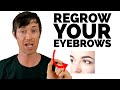 Can Thyroid Problems Cause Eyebrow Loss