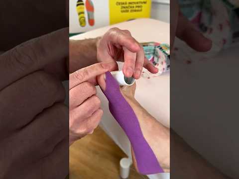Taping Hallux Valgus – correction using a roll separating the toes.