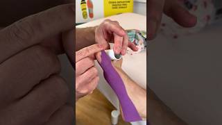 Download lagu Taping Hallux Valgus – correction using a roll separating the toes. mp3
