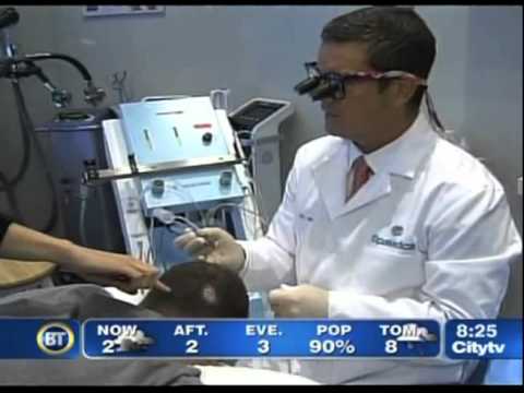 NeoGraft Hair Transplantation on BT Toronto | SpaMedicaTV
Video Thumbnail