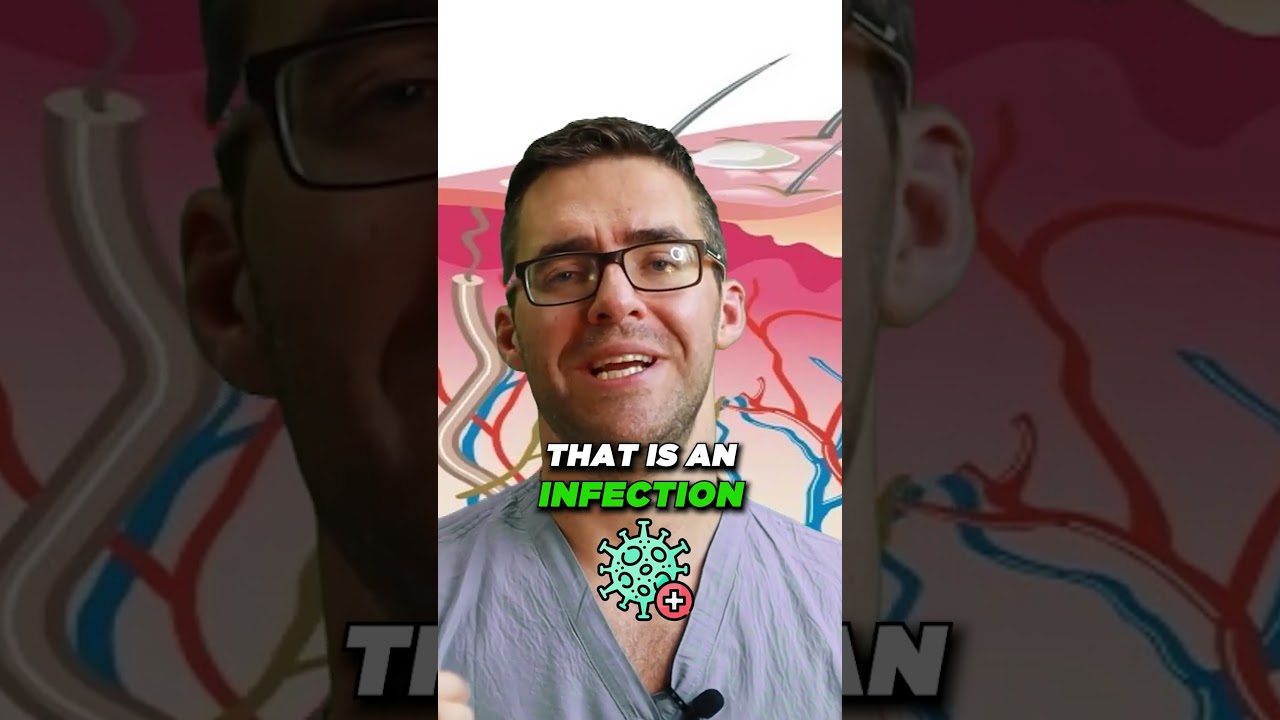 How to Get Rid of Blisters on Feet [How to Cure Blisters FAST!]