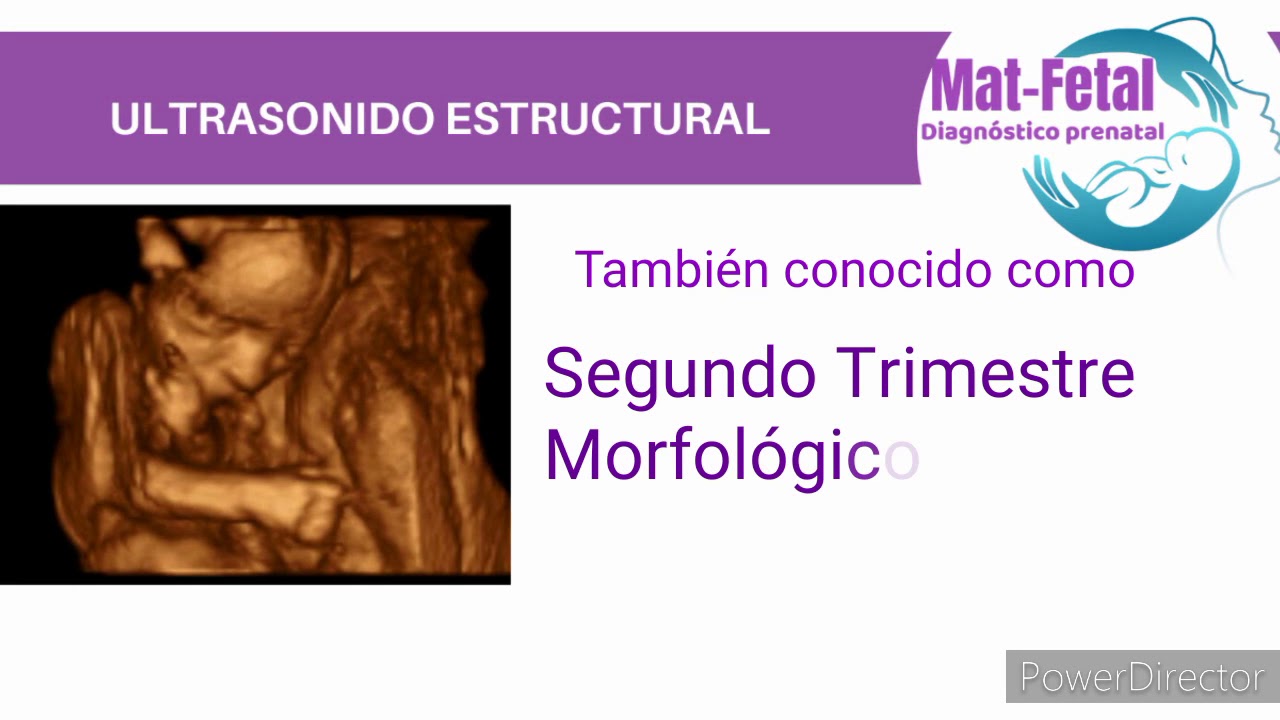 Rafael Gibran Yrigoyen Carranza-6