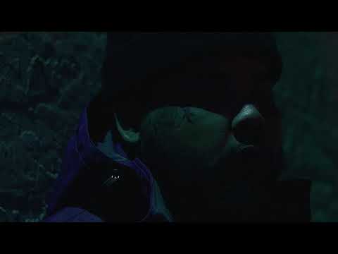 Video thumbnail for Broken Shoulder