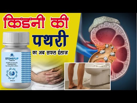 Ayurvedic Stoneflip Capsule, For Kidney Stone
