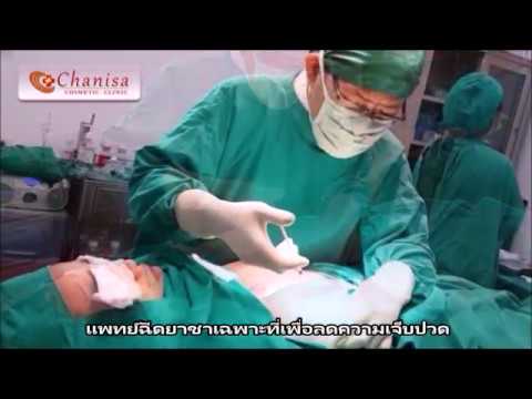 การผ่าตัดเต้านมซิลิโคน สาวที่มีหน้าอกเล็กส่วนตัว