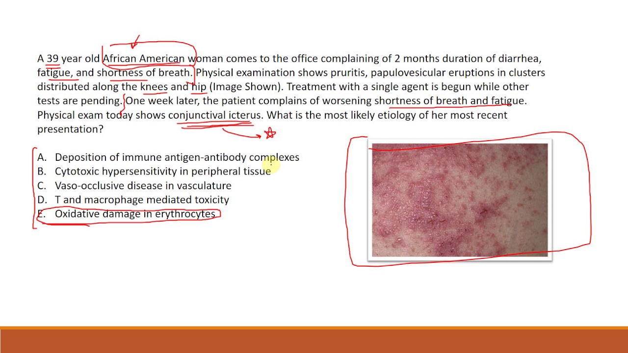 Test Taking Strategies - USMLE Step 2 CK