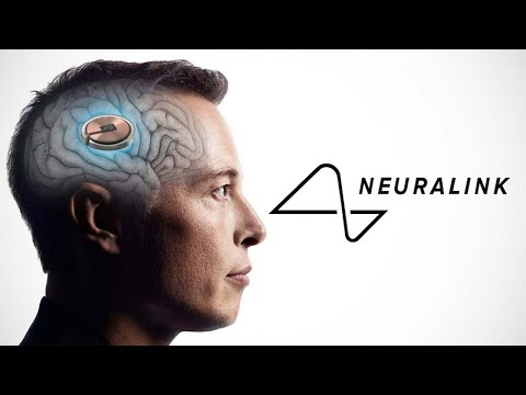 KAMPUNI YA ELON MUSK YAPANDIKIZA 'CHIP' KWENYE UBONGO WA BINADAMU "NEURALINK"