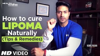 What Is Lipoma (लाइपोमा) ?  How to cure LIPOMA Naturally | Tips by Guru Mann