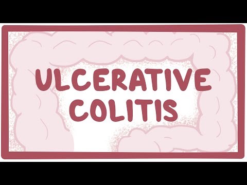 Ulcerative colitis - causes, symptoms, diagnosis, treatment, pathology
