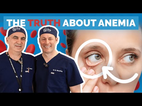 Anemia? Maybe It’s Due To Low Iron