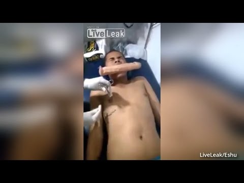 Naprawdę można powiększyć penisa z kremem Małe krosty na penisie
