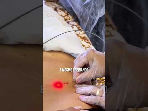 Thumbnail do vídeo 1