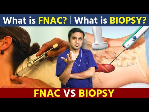 FNAC vs. Biopsy: What's the Difference? All Explained By Dr. Ashank Bansal