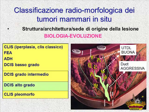 Sostituzione dellarticolazione del gomito in Cheboksary RMN del rachide cervicale con mezzo di contrasto