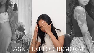 I regret my Tattoos + I'm getting them ALL REMOVED! | Tattoo Removal Journey